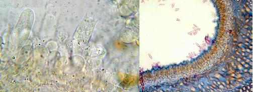 Foto microscopio de basidios y cistidios en láminas Foto microscopio de basidios en poros